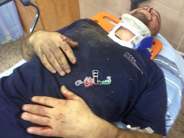 باقة الغربية: إنفجار مكييف هواء بوجه الشاب بلال مسعد لحام ونقلة للمشفى